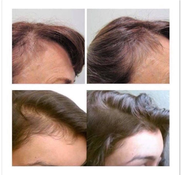 AYCNOOR – Huile capillaire aux 14 huiles naturelles