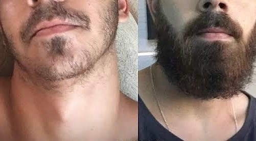 SOIN BARBE — AUX 9 HUILES NATURELLES ✨