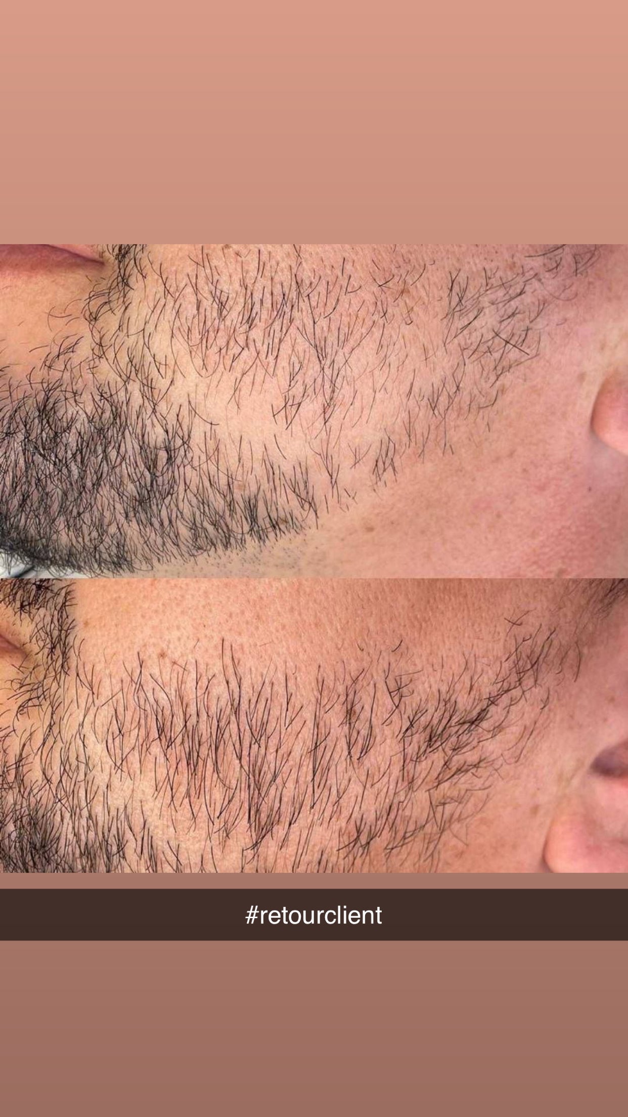 SOIN BARBE — AUX 9 HUILES NATURELLES ✨