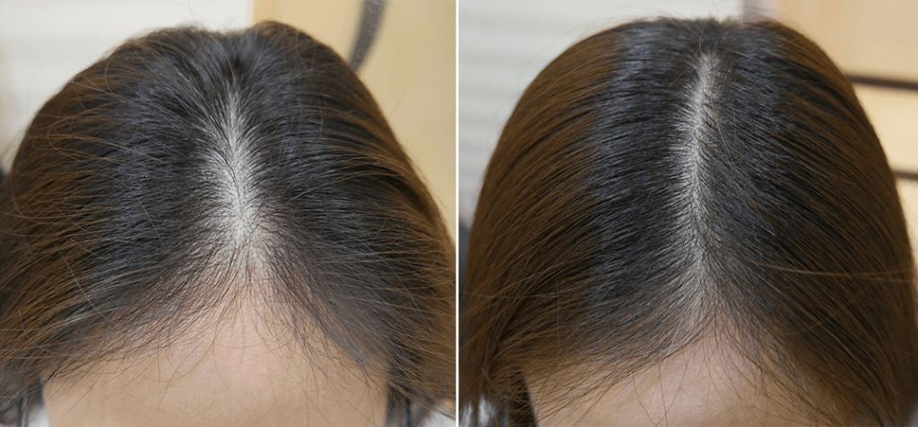 AYCNOOR – Huile capillaire aux 14 huiles naturelles