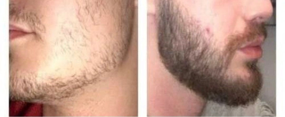 SOIN BARBE — AUX 9 HUILES NATURELLES ✨