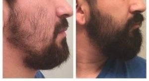 SOIN BARBE — AUX 9 HUILES NATURELLES ✨