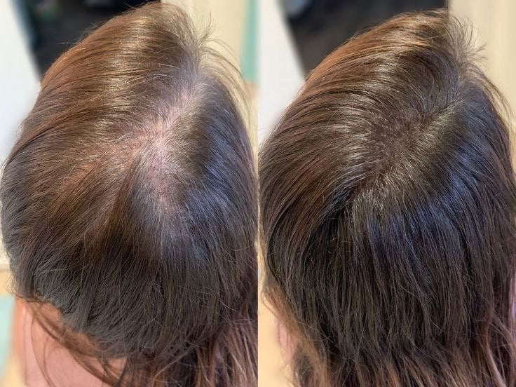AYCNOOR – Huile capillaire aux 14 huiles naturelles