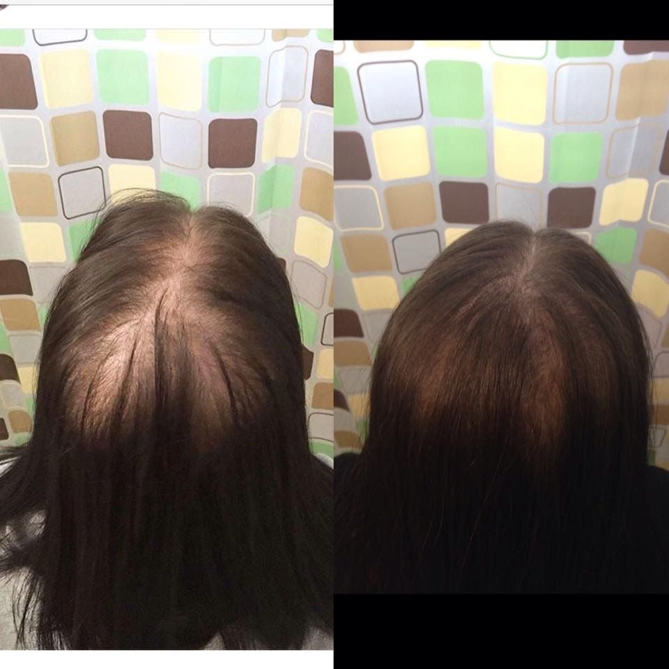 AYCNOOR – Huile capillaire aux 14 huiles naturelles