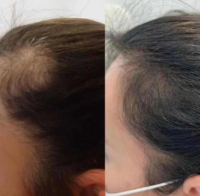 AYCNOOR – Huile capillaire aux 14 huiles naturelles