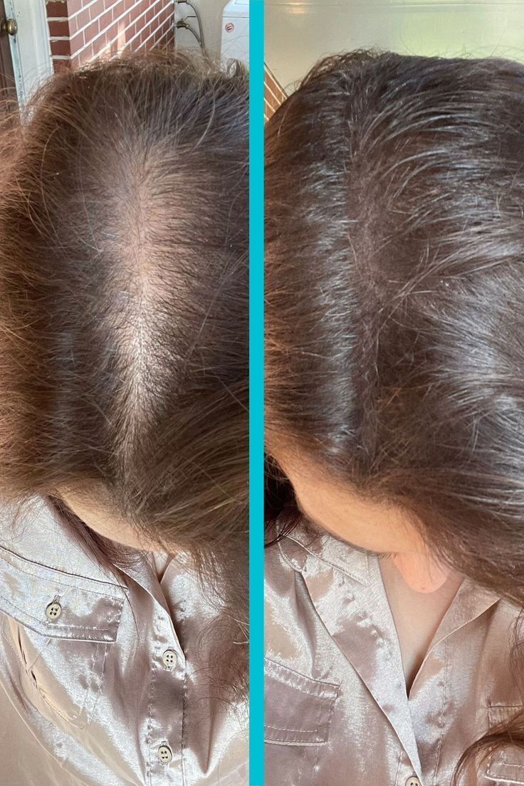 AYCNOOR – Huile capillaire aux 14 huiles naturelles