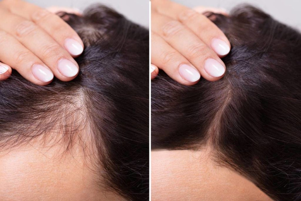 AYCNOOR – Huile capillaire aux 14 huiles naturelles