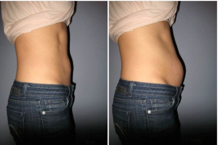 Infusion Légèreté AYCNOOR & VELYA