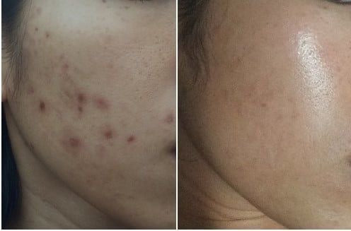 MYA Visage - Soin Visage Purifian