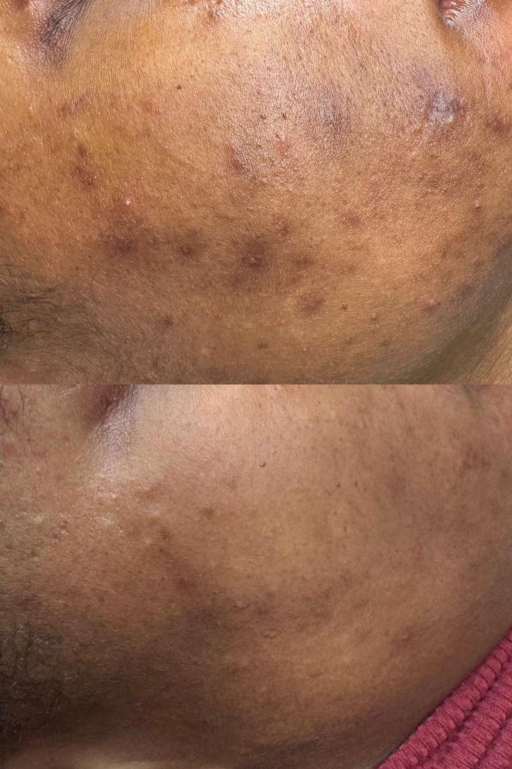 Soin Visage - Soin Visage Purifian