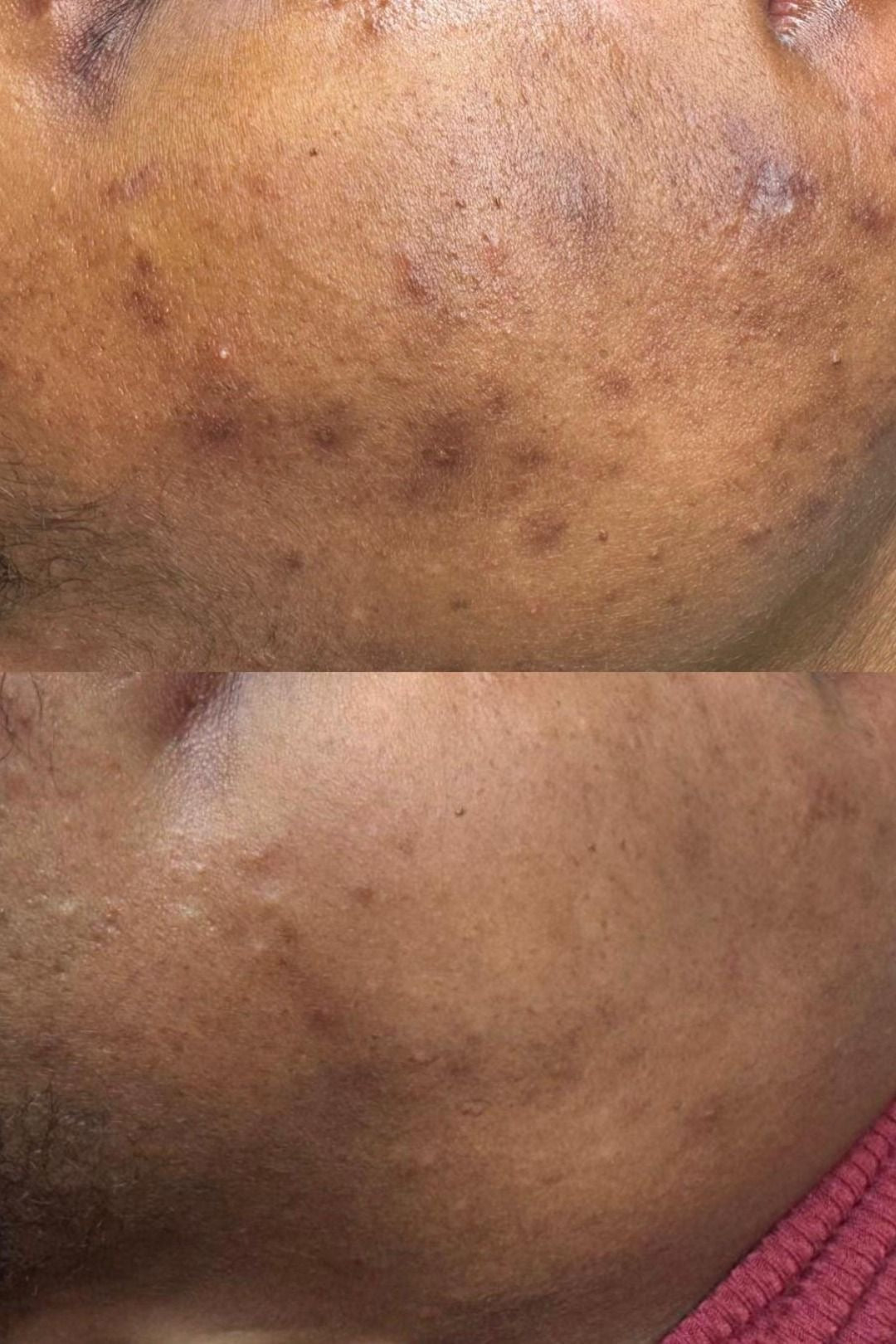 MYA Visage - Soin Visage Purifian