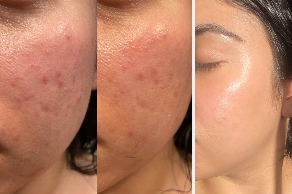 MYA Visage - Soin Visage Purifian
