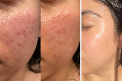 MYA Visage - Soin Visage Purifian