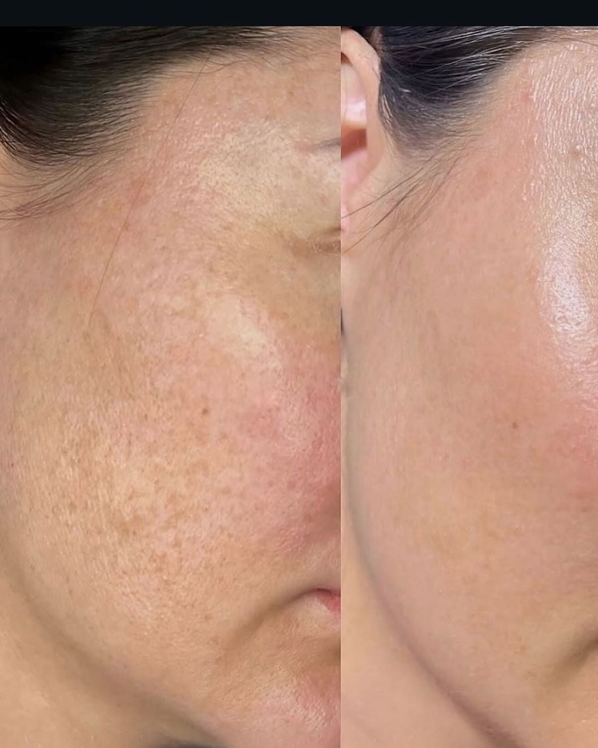 MYA Visage - Soin Visage Purifian