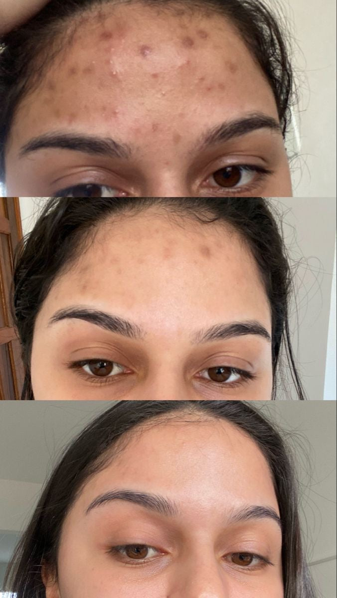 Soin Visage - Soin Visage Purifian
